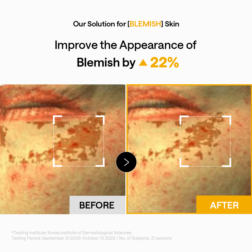 Mediheal Vita Collagen Eye Ampoule Patch - view 5