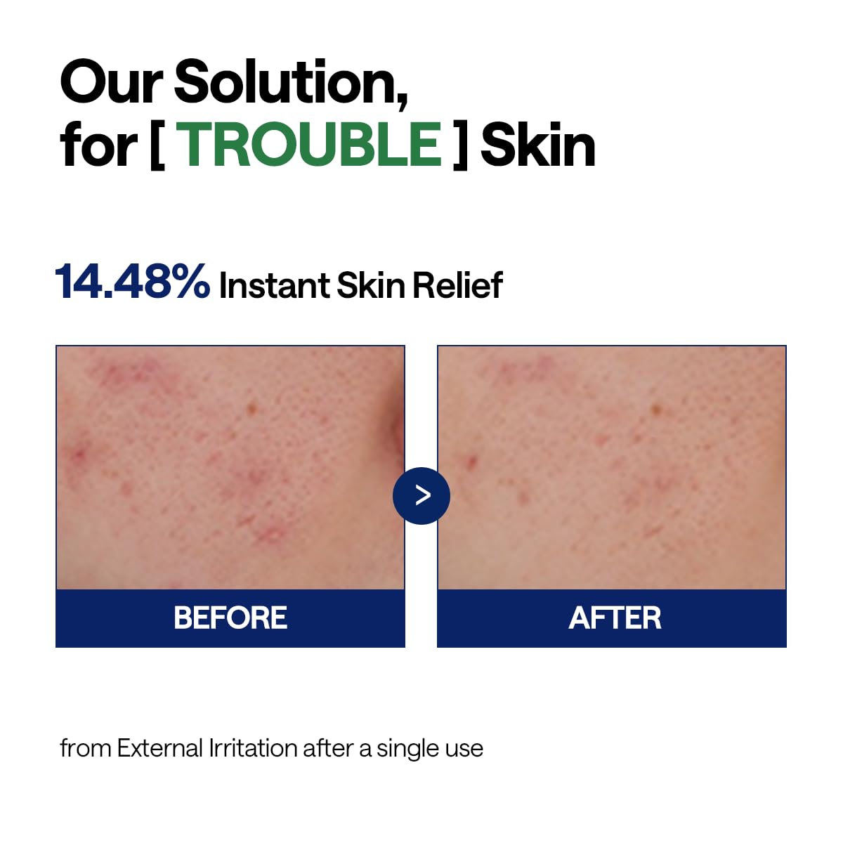 Mediheal Teatree Calming Hydra Serum - view 6