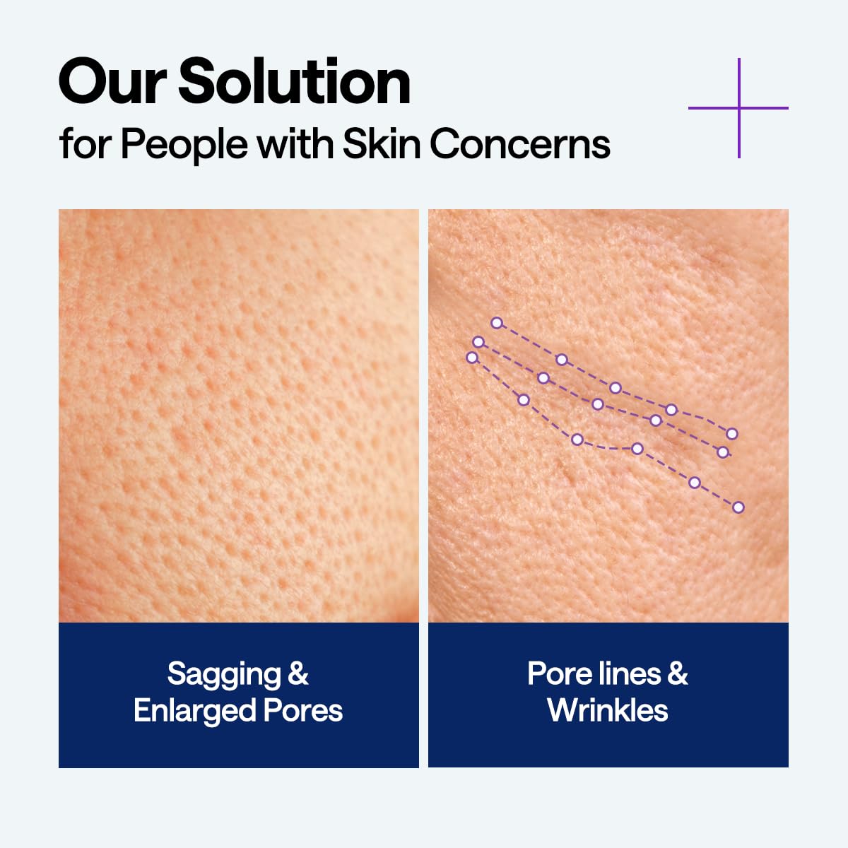 Mediheal PDRN Lifting Serum - view 4