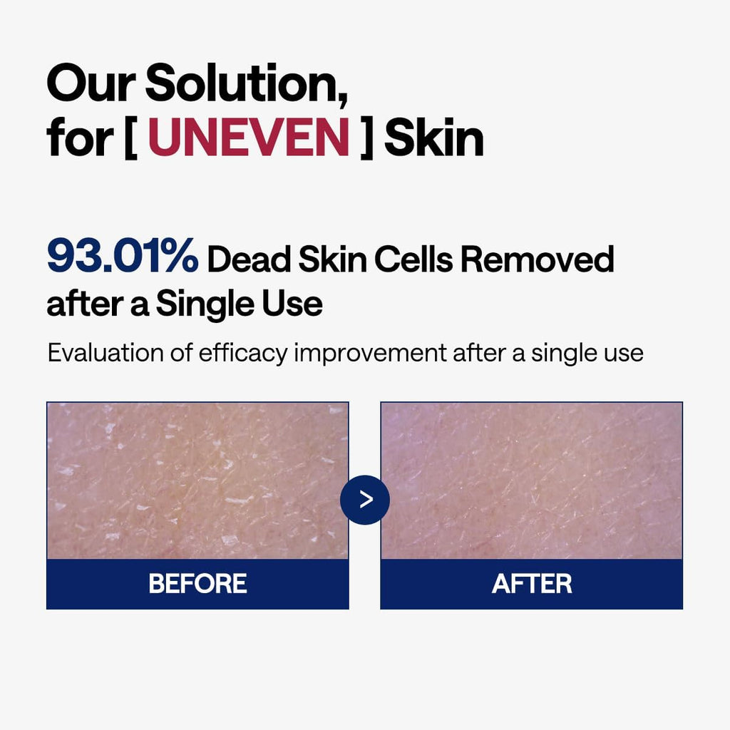 Mediheal Phyto-enzyme Peeling Pad - view 4