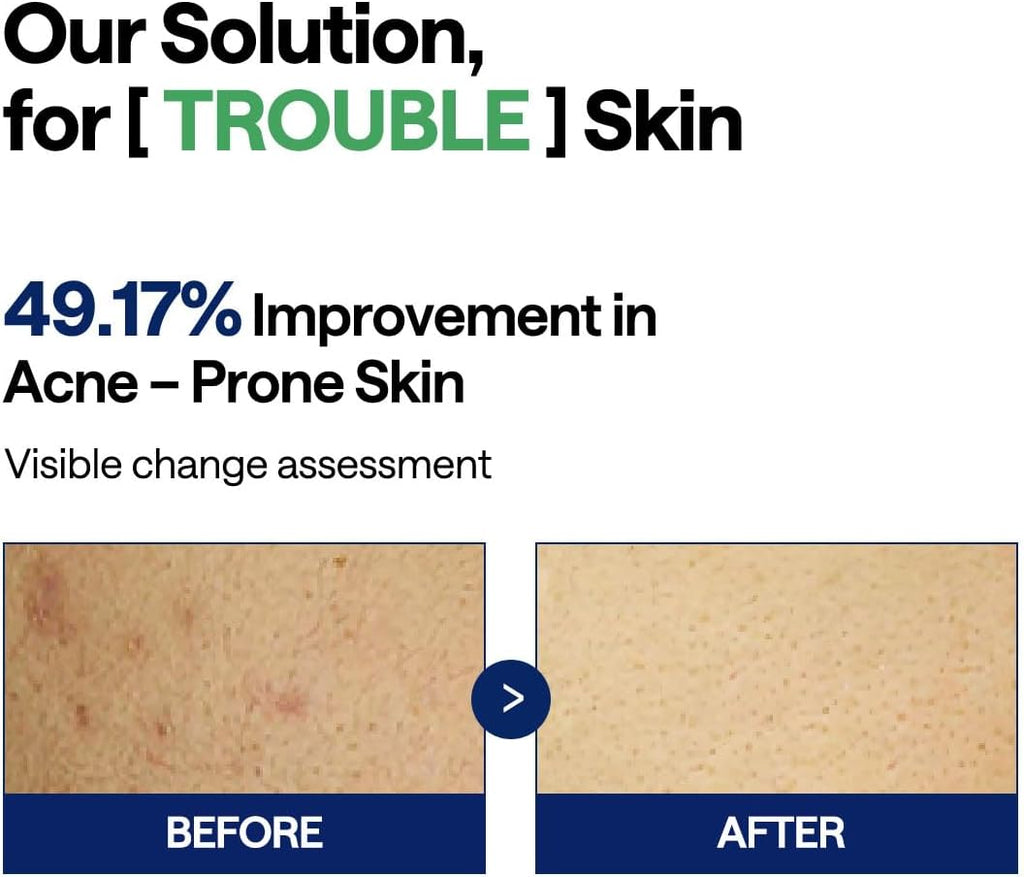 Mediheal Teatree Trouble Pad 1+1 - view 5