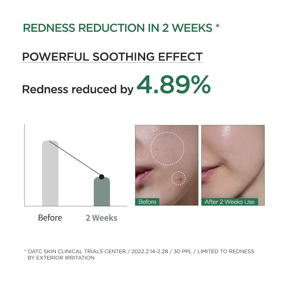 Anua Heartleaf 80% Moisture Soothing Ampoule - view 3