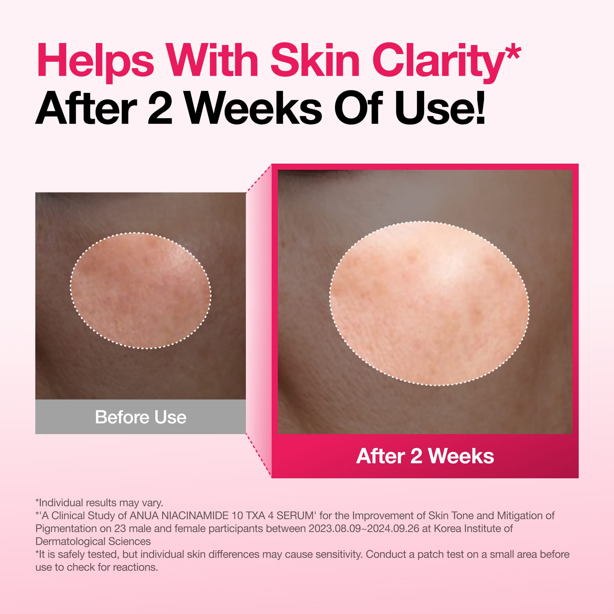Anua Spotless Skin Duo - view 3