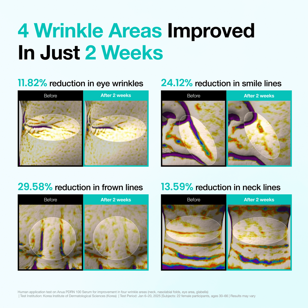 Anua [First 100 Only] Wrinkle-Out Set - view 5