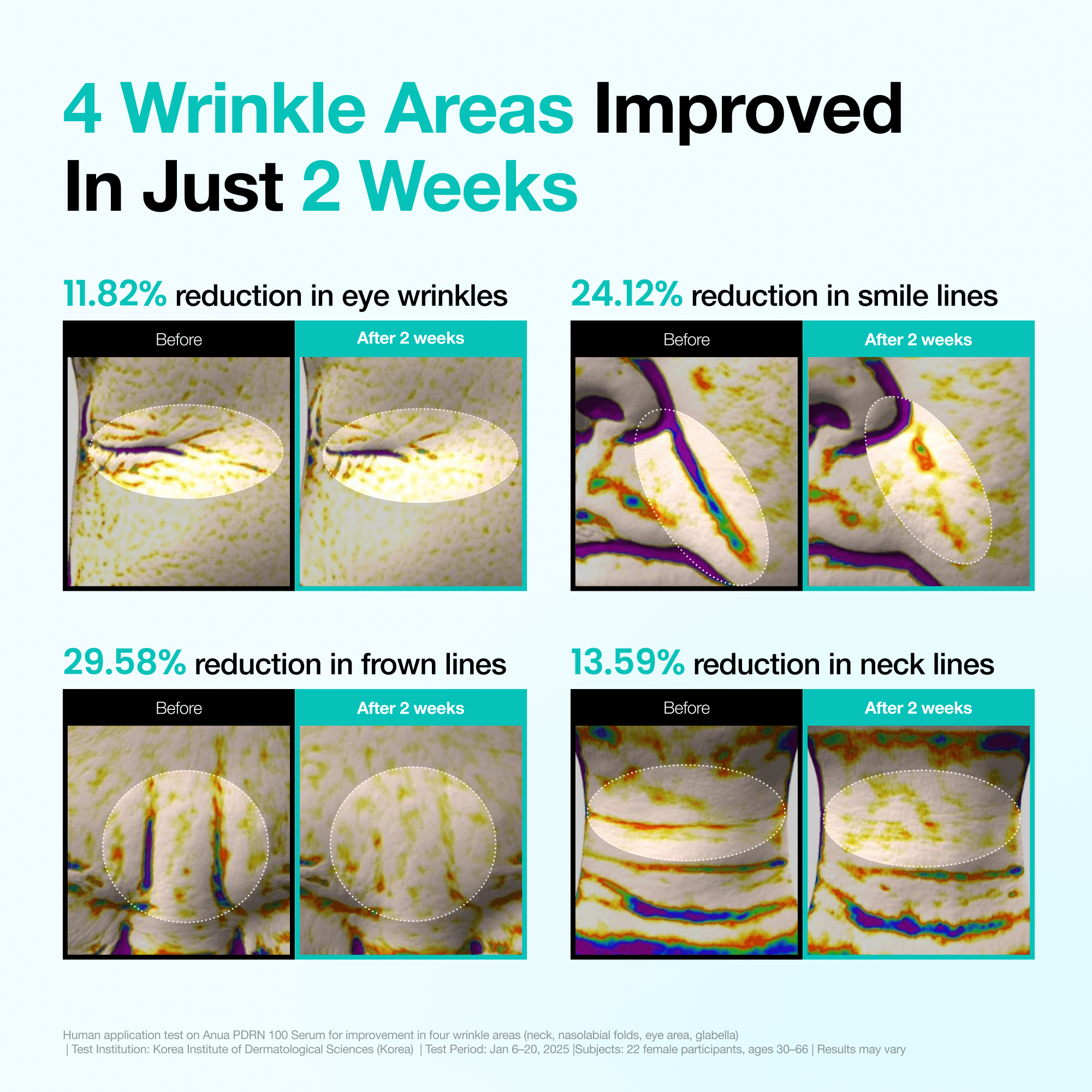 Anua [First 100 Only] Wrinkle-Out Set - view 5