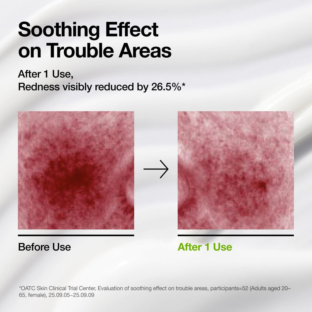 Anua Azelaic Acid CICA Skin Soothing Moisturizer - view 3