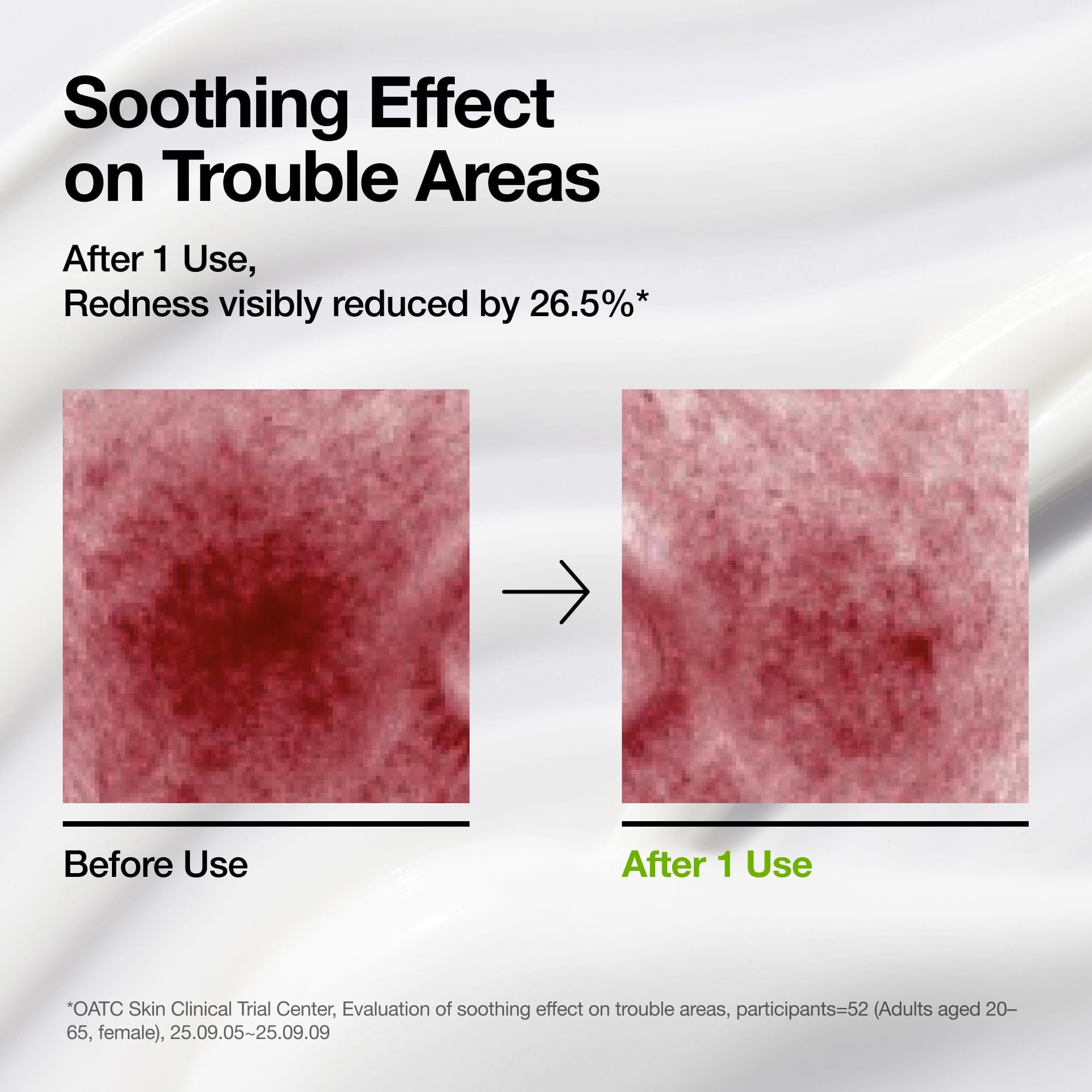 Anua Azelaic Acid CICA Skin Soothing Moisturizer - view 3