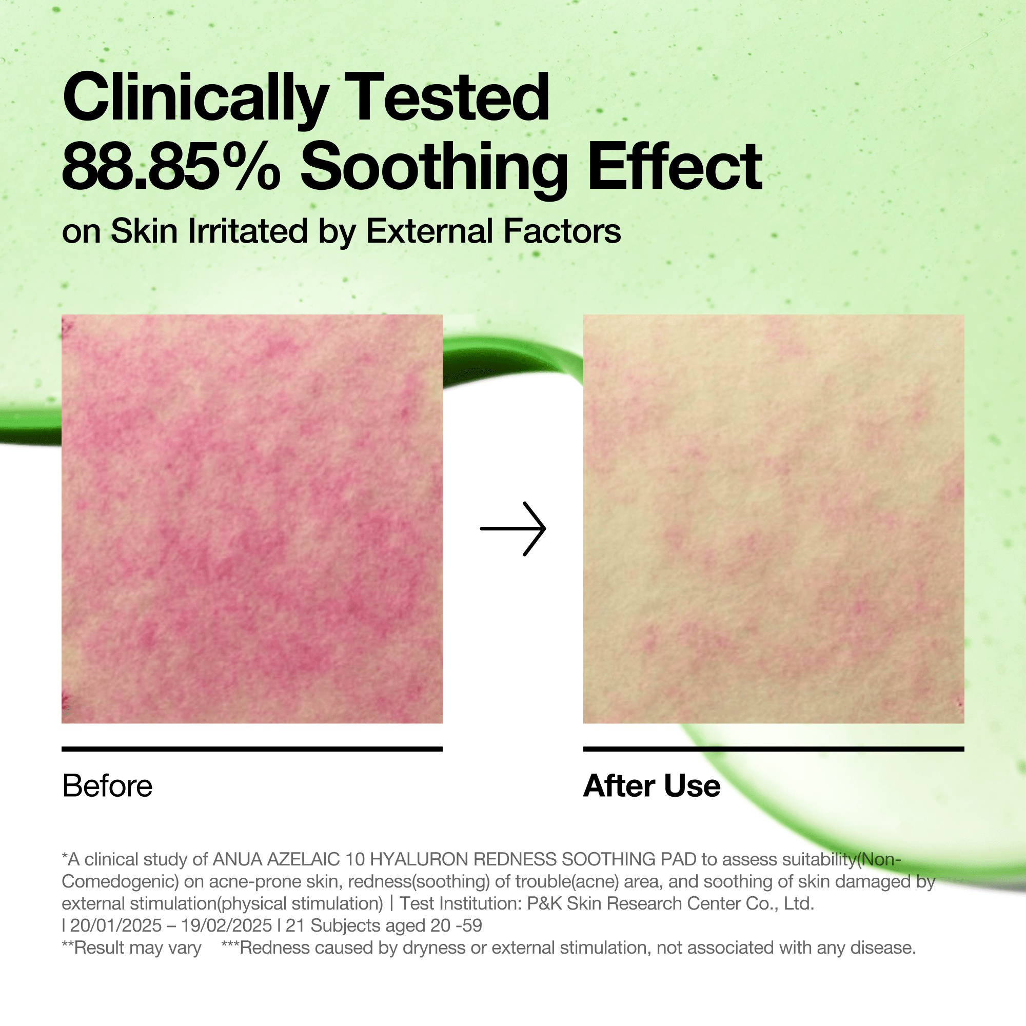 Anua Azelaic 10 Hyaluron Redness Soothing Pad - view 3