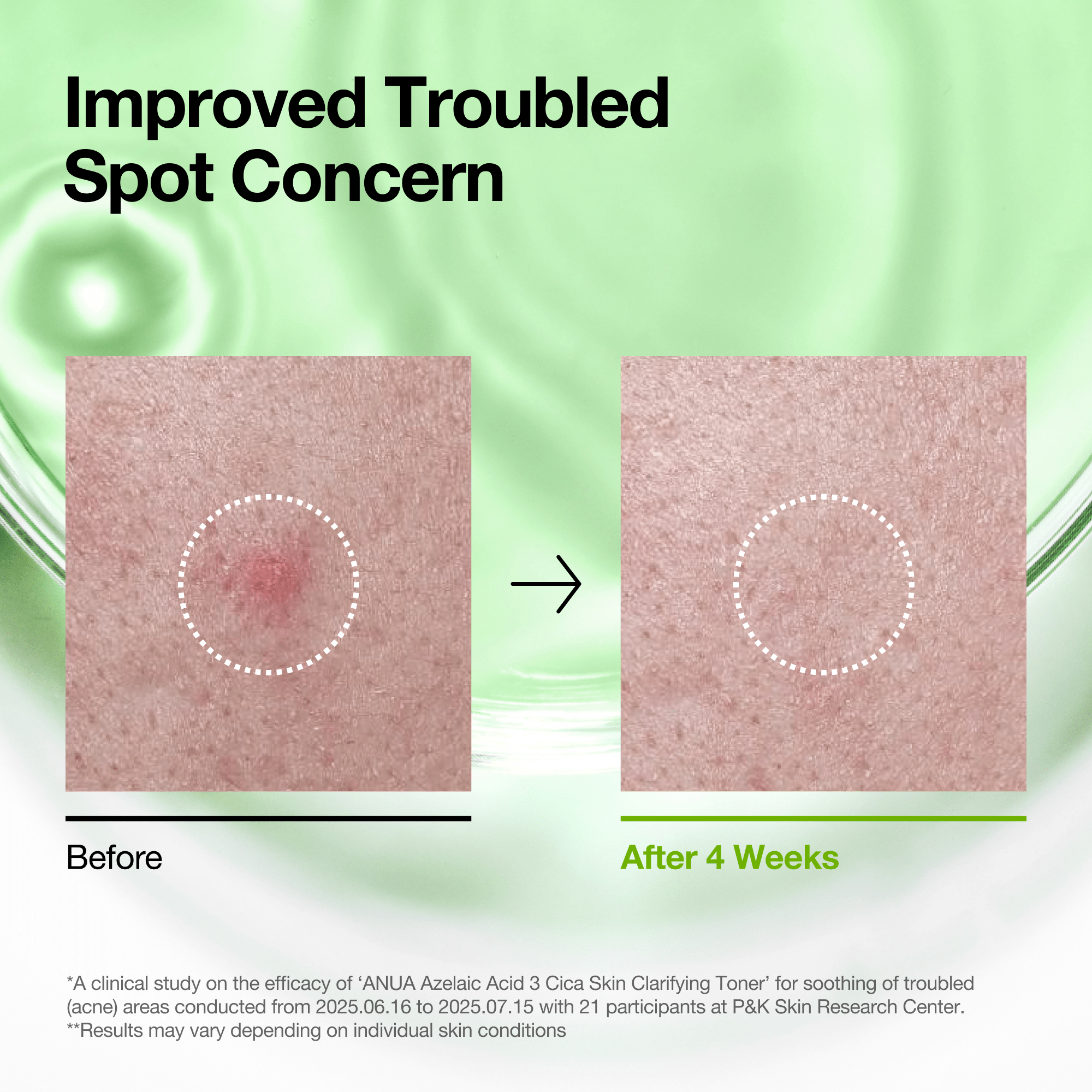 Anua Azelaic 3 Cica Skin Clarifying Toner - view 3