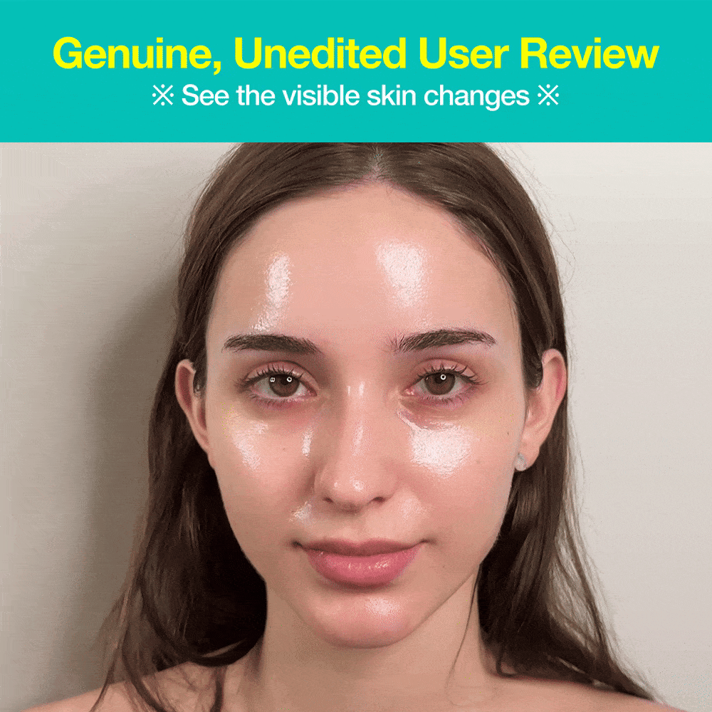 Anua [First 100 Only] Wrinkle-Out Set - view 2